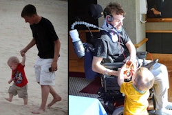 David Williams before and after his fleet truck accident which a Pennsylvania court declared was caused by a bald tire.