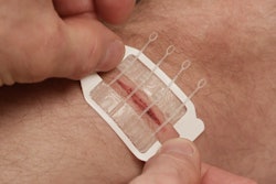 ZipStitch